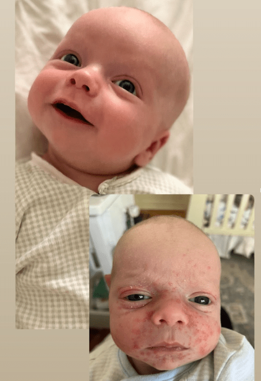 How I Recognized the Signs of Dairy Intolerance in My Breastfed Baby Before It Got&nbsp;Worse